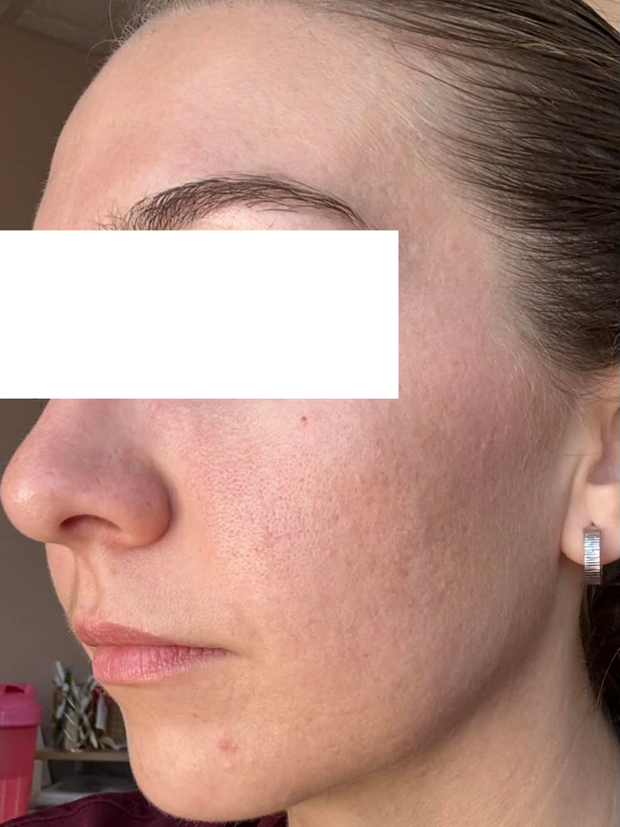 After treatment