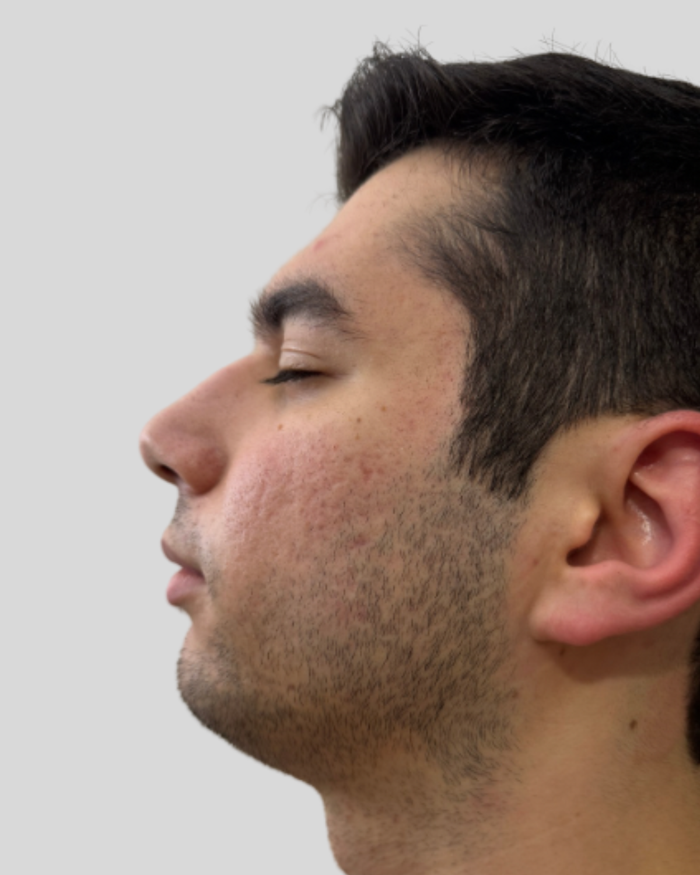 After treatment